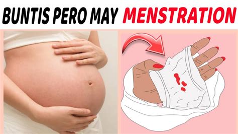 Buntis Pero May Regla .